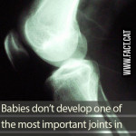 Do babies have kneecaps?